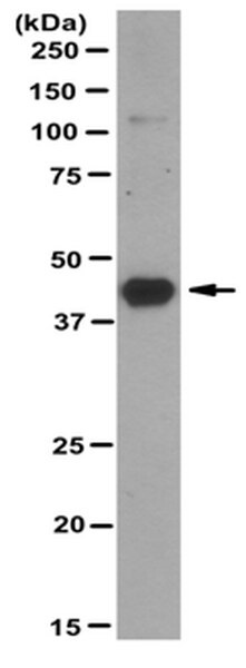 Anti-Osterix (SP7) Antibody, clone 6B12.1 | MABT179